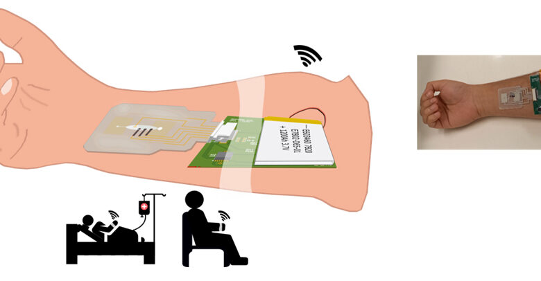 Sweat based non-invasive point of health diagnosis technology
