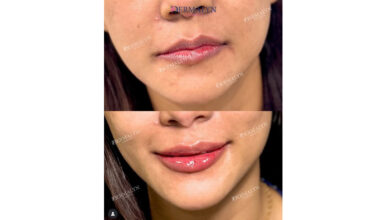Natural Beauty, Dr Ajay Rana, dermatologist, aesthetic physician, ILAMED