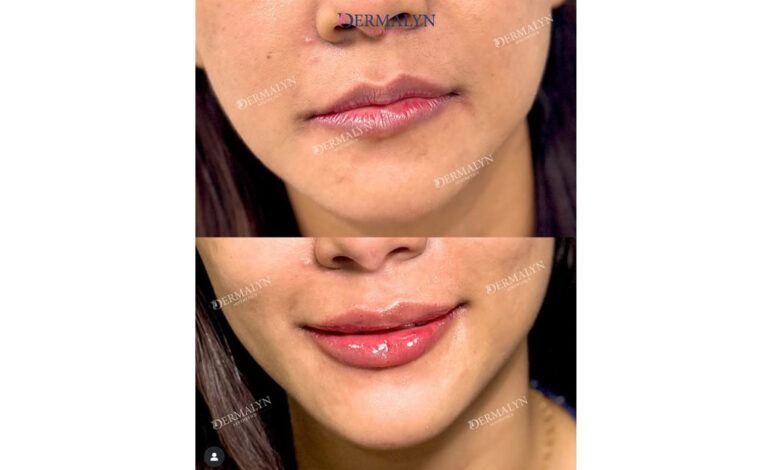 Natural Beauty, Dr Ajay Rana, dermatologist, aesthetic physician, ILAMED